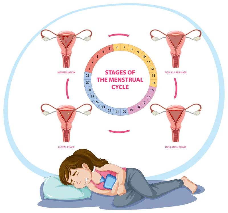 Polycystic Ovary Syndrome (PCOS): Symptoms, Causes and Treatment
