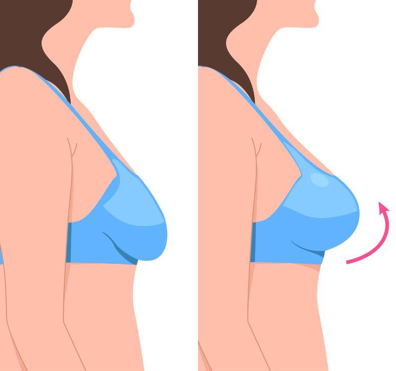 Get rid of saggy breasts with ayurveda. Works on women of all ages