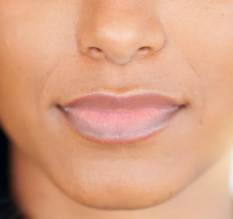 Lip Pigmentation: Causes, Treatment and Effective Home Remedies